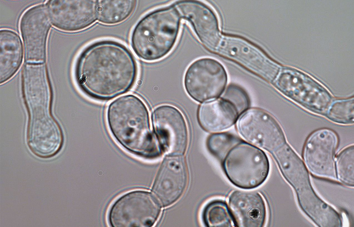 The-symbiotic-fungus-Ambrosiella-in-mycangium