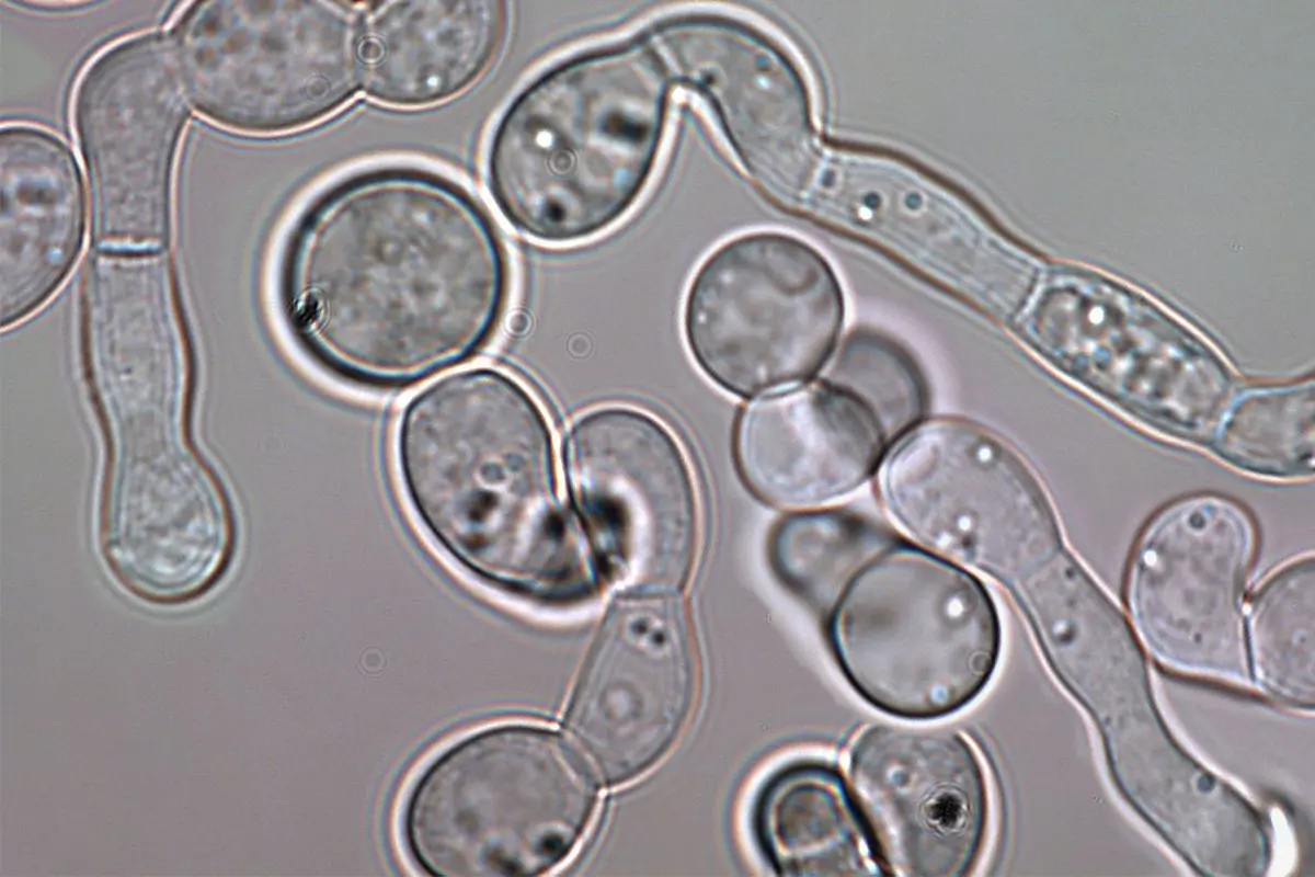 The-symbiotic-fungus-Ambrosiella-in-mycangium